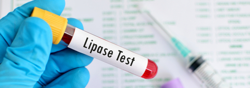 בדיקת ליפאז (Lipase) - תמונה